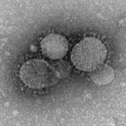 Middle East respiratory syndrome coronavirus